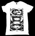 Rotten teeth top
