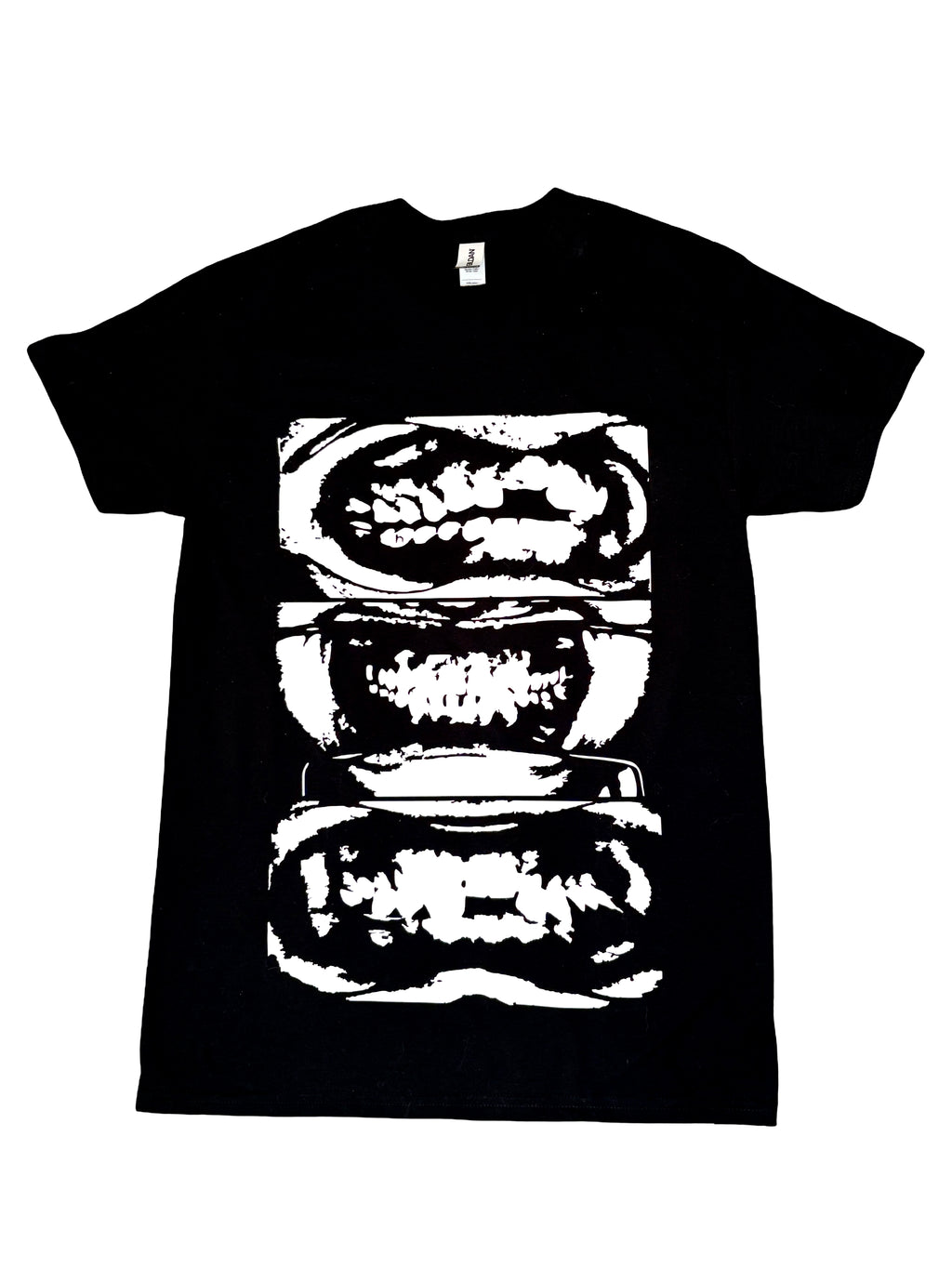 Rotten teeth top